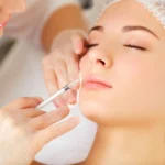 Top 10 Questions First-Time Botox Patients Ask