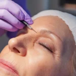 Recovery Tips After Eyelid Surgery